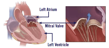 Pet heart valve diagram