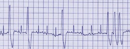 pet ECG scan