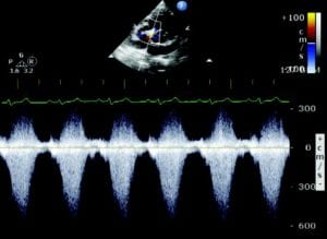 Pet ultrasound scan