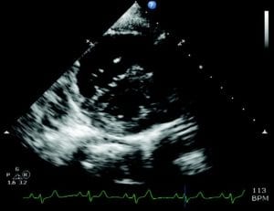 Pet ultrasound scan